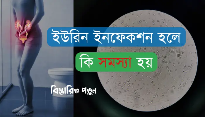 ইউরিন ইনফেকশন হলে কি সমস্যা হয়