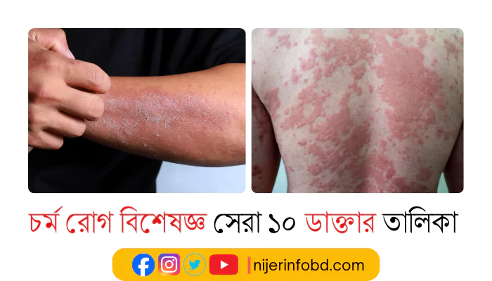 চর্ম রোগ বিশেষজ্ঞ সেরা ১০ ডাক্তার তালিকা