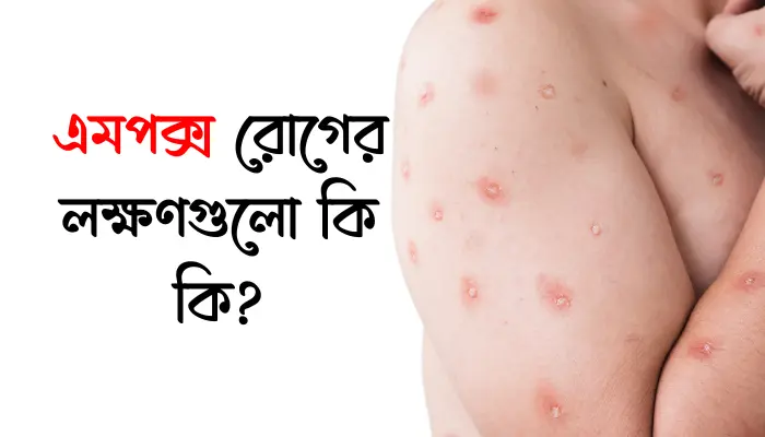 এমপক্স রোগের লক্ষণগুলো কি কি?