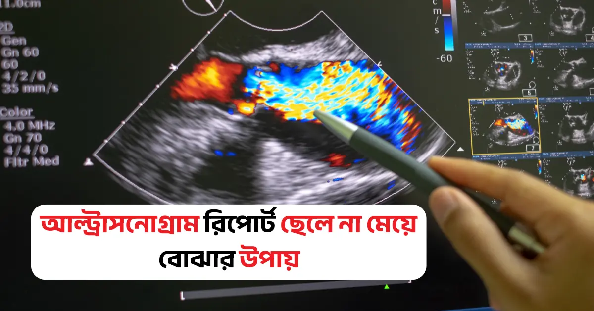আল্ট্রাসনোগ্রাম রিপোর্ট ছেলে না মেয়ে বোঝার সহজ উপায়