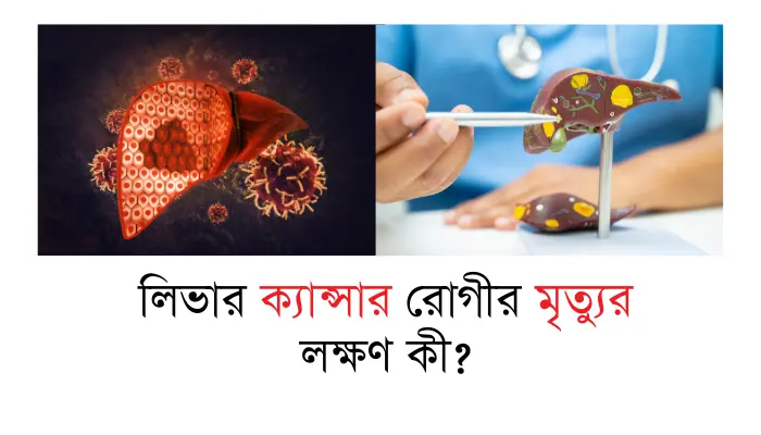 লিভার ক্যান্সার রোগীর মৃত্যুর লক্ষণ কী?